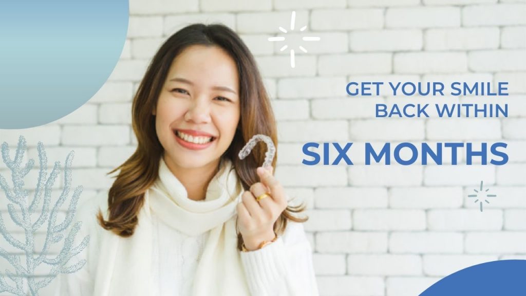 GET YOUR SMILE BACK WITHIN SIX MONTHS