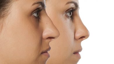 Photo of What Makes Nose Job After Surgery Are Effective?