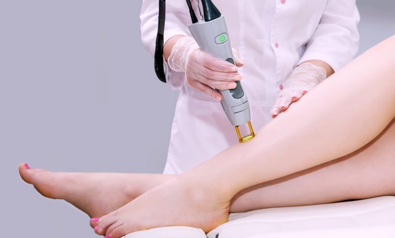 10 laser hair removal myths have been leaked