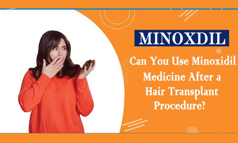 Minoxidil- Can You Use Minoxidil Medicine After a Hair Transplant Procedure?