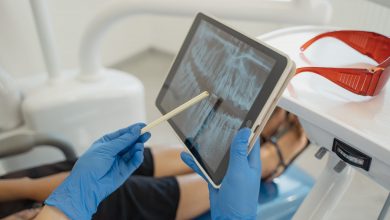 Photo of Essential Benefits of Regular Dental Visits