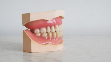 Photo of What Do We Consider Dental Emergencies?