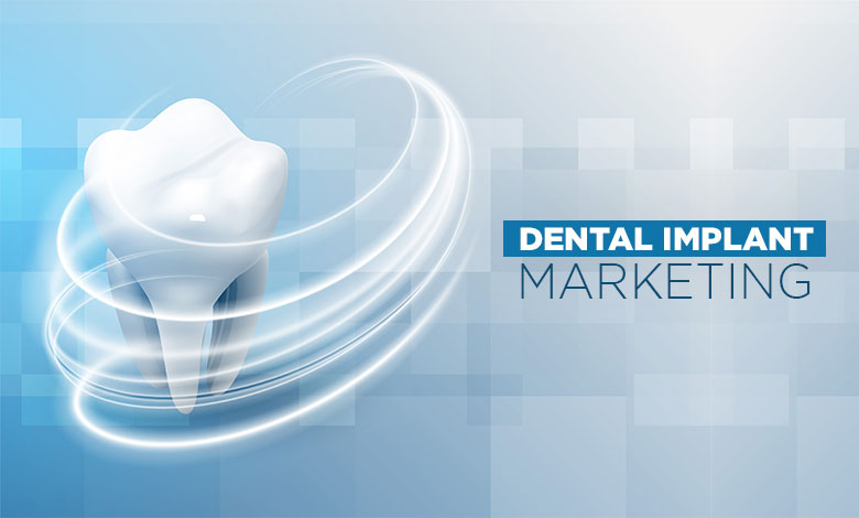 Dental Implant Social Media Marketing