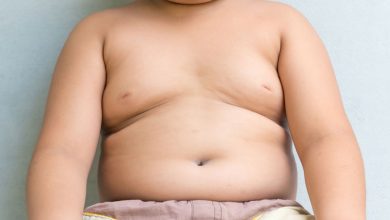 Photo of CHILDHOOD OBESITY AND HOW TO TREAT IT
