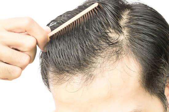 hair loss treatment 