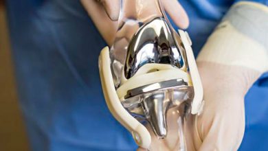 Photo of How long does knee replacement surgery take?