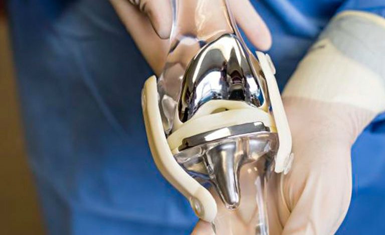 Knee replacement surgery