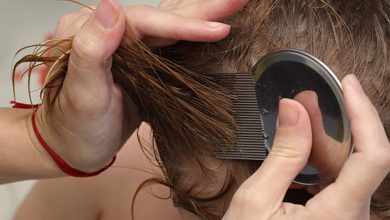 Photo of Ultimate Guide For Head Lice Removal