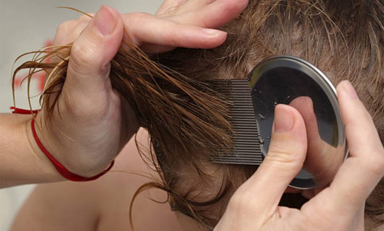 lice removal