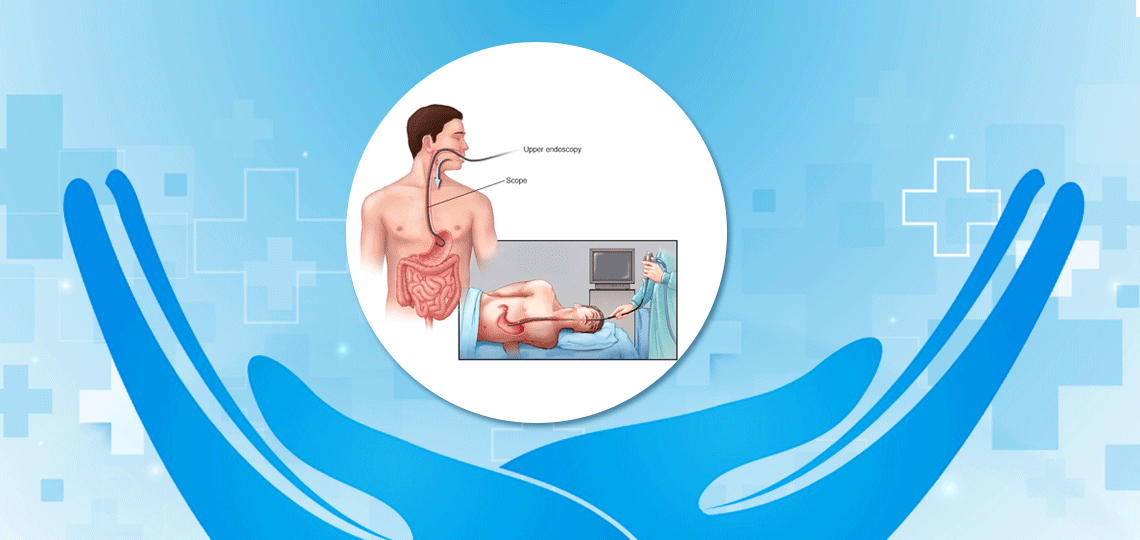 Photo of Why endoscopy is conducted