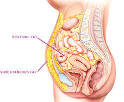 Photo of What Is Visceral Fat?