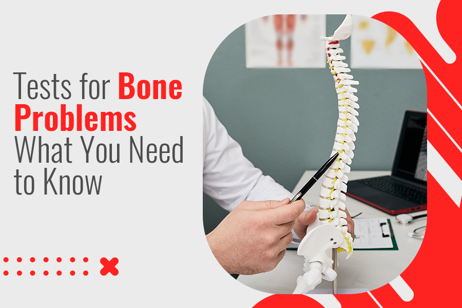 Tests for Bone Problems: What You Need to Know