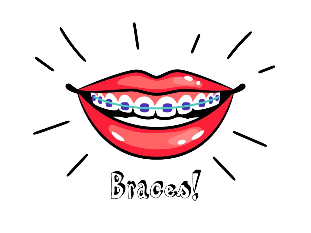 Braces Penang