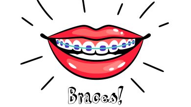 Photo of  How to Tell if You Need Braces Penang