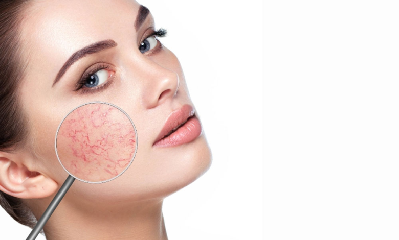 skin lesion removal Dubai