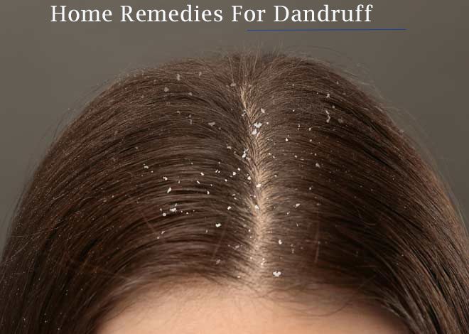 Home remedies for dandruff