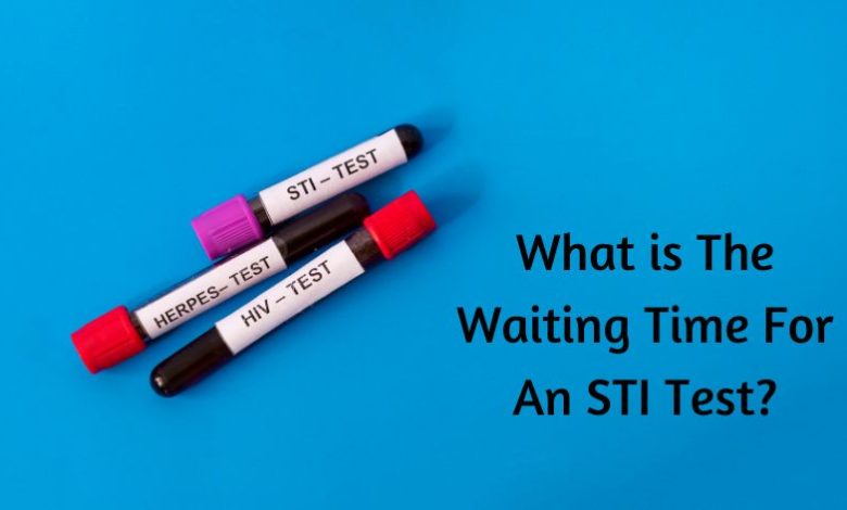 What is The Waiting Time For An STI Test?