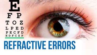 Photo of Refractive error- Bharti eye foundation