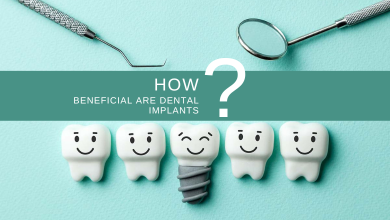 Photo of How Beneficial Are Dental Implants?