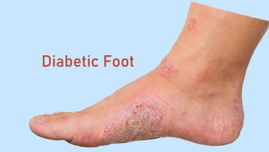 Photo of Why Choose a Podiatrist for Diabetic Foot Care?