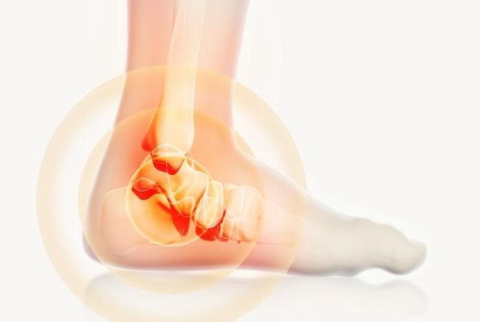 Ankle Popping