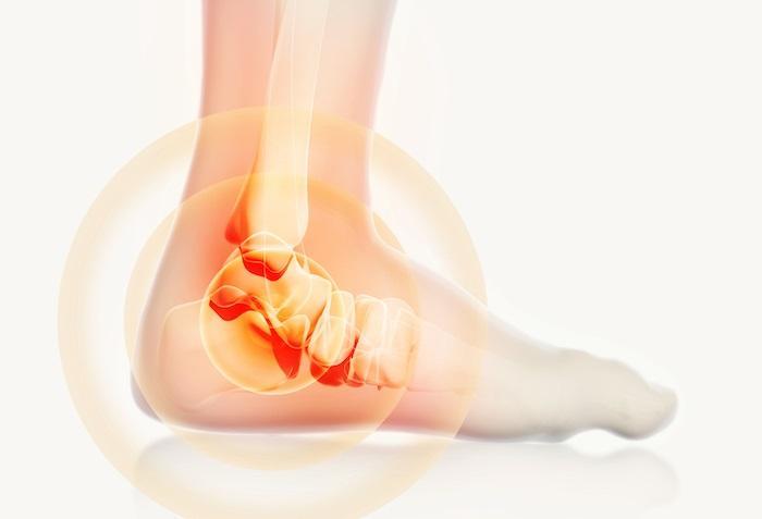 Ankle Popping